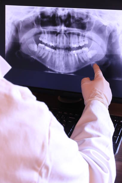 Best Emergency Dentist for Knocked-Out Tooth in Wildwood, TN